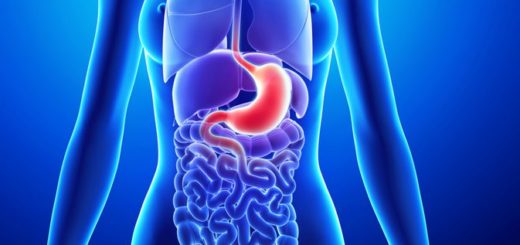 Reflux nepodceňujte. Je to výstražný proporek před chronickými nemocemi. Přinášíme program jeho léčby